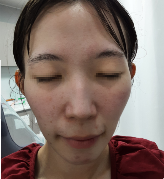시술 전