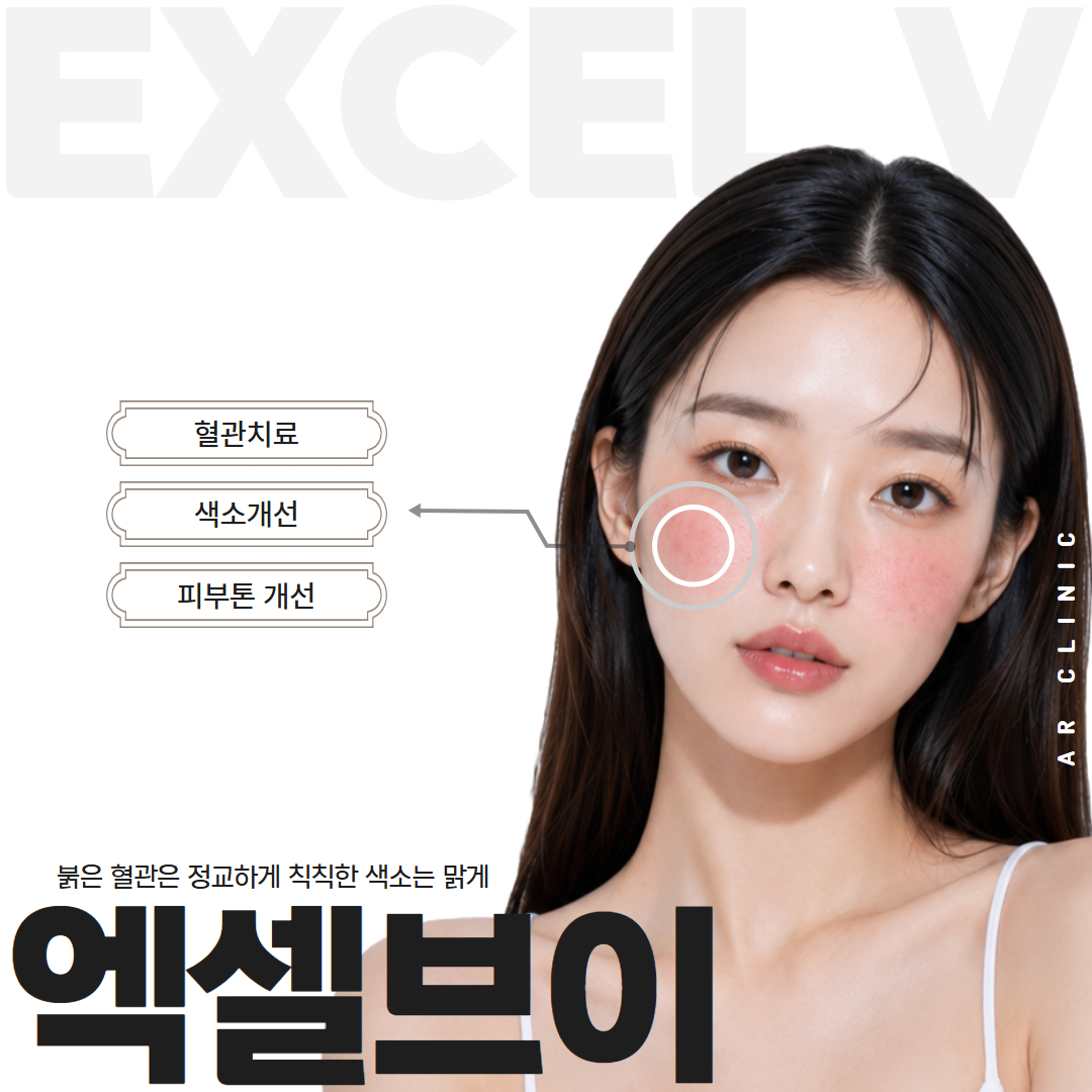 엑셀브이