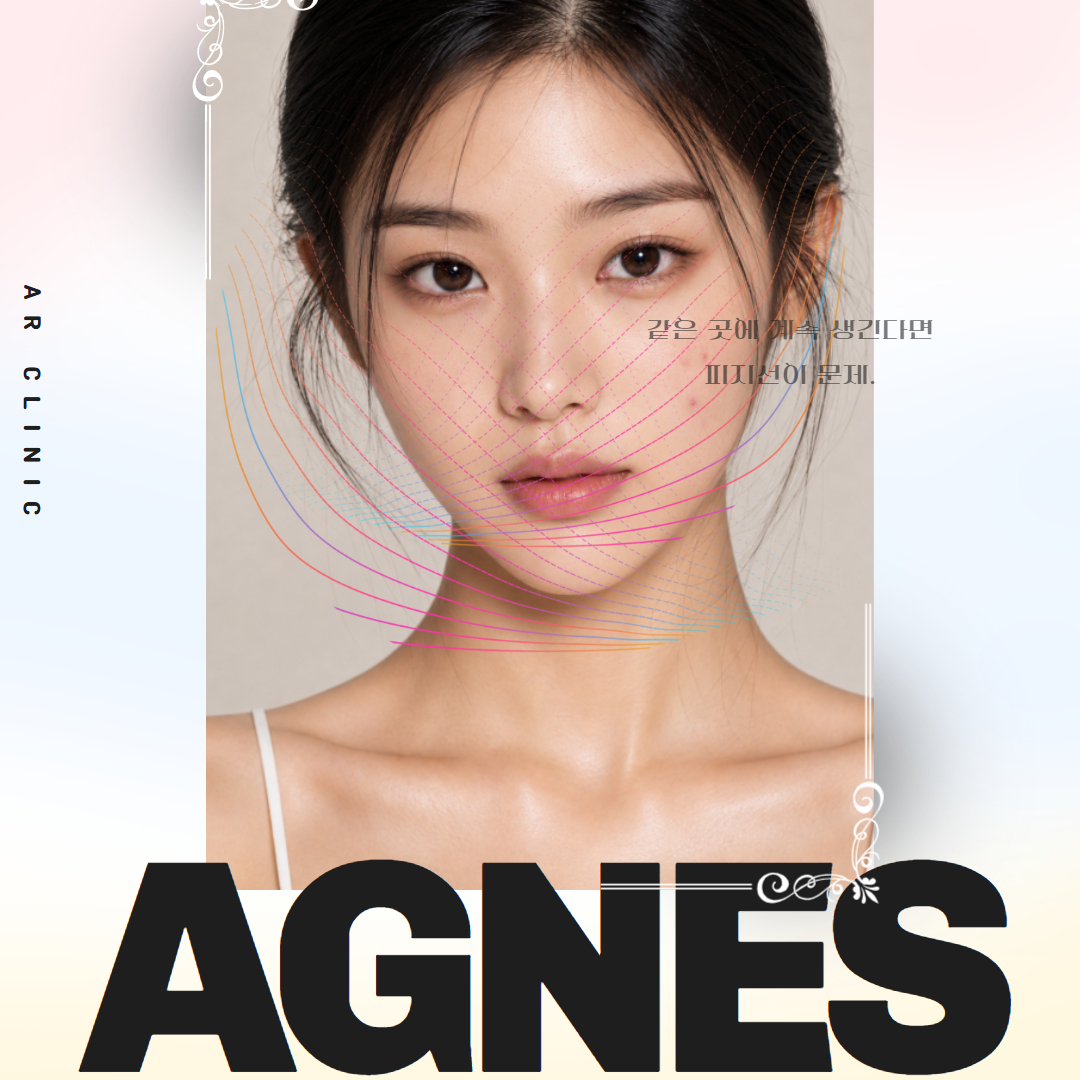 아그네스